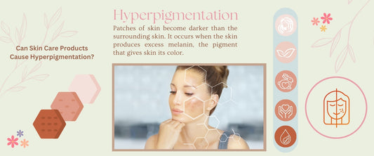 Can Skin Care Products Cause Hyperpigmentation? - Essentials Everything